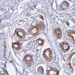 CCDC48 Polyclonal Antibody