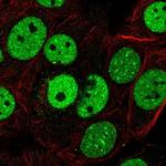 SAFB2 Polyclonal Antibody