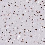 SAFB2 Antibody in Immunohistochemistry (Paraffin) (IHC (P))