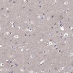 RTP5 Antibody in Immunohistochemistry (Paraffin) (IHC (P))