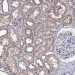 RTP5 Antibody in Immunohistochemistry (Paraffin) (IHC (P))