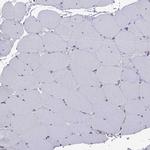 RTP5 Antibody in Immunohistochemistry (Paraffin) (IHC (P))