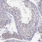 RTP5 Antibody in Immunohistochemistry (Paraffin) (IHC (P))