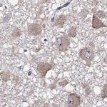 RTP5 Antibody in Immunohistochemistry (IHC)