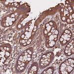 C10orf76 Antibody in Immunohistochemistry (Paraffin) (IHC (P))