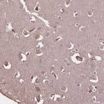 C10orf76 Antibody in Immunohistochemistry (Paraffin) (IHC (P))