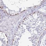 PLAC1L Polyclonal Antibody