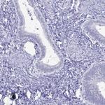 PLAC1L Antibody in Immunohistochemistry (IHC)