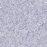 C10orf99 Polyclonal Antibody
