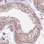 C14orf140 Antibody in Immunohistochemistry (IHC)