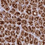 CYSTM1 Antibody in Immunohistochemistry (Paraffin) (IHC (P))