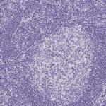 CYSTM1 Antibody in Immunohistochemistry (IHC)