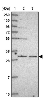 RNF170 Antibody in Western Blot (WB)
