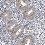 SBF2 Antibody in Immunohistochemistry (Paraffin) (IHC (P))