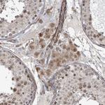 SBF2 Antibody in Immunohistochemistry (Paraffin) (IHC (P))
