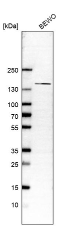 SBF2 Antibody in Western Blot (WB)