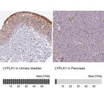 LYPLA1 Polyclonal Antibody