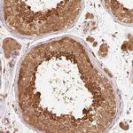 RRAS2 Polyclonal Antibody