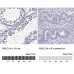 FBXO24 Polyclonal Antibody