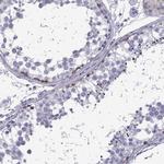 FBXO24 Antibody in Immunohistochemistry (IHC)