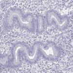 FBXO24 Antibody in Immunohistochemistry (IHC)