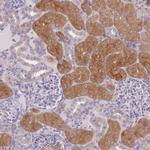 OR5T1 Polyclonal Antibody