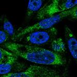 AVL9 Polyclonal Antibody