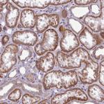 AVL9 Antibody in Immunohistochemistry (Paraffin) (IHC (P))