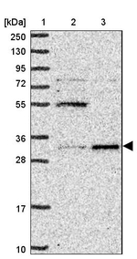 UCK1 Antibody in Western Blot (WB)