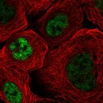 SRSF4 Polyclonal Antibody