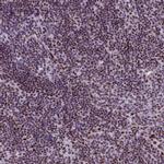 SRSF4 Antibody in Immunohistochemistry (IHC)