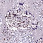 SRSF4 Antibody in Immunohistochemistry (IHC)