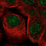 ZNF524 Polyclonal Antibody