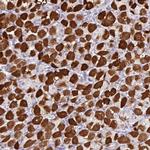 ZNF524 Antibody in Immunohistochemistry (Paraffin) (IHC (P))