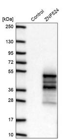 ZNF524 Antibody in Western Blot (WB)