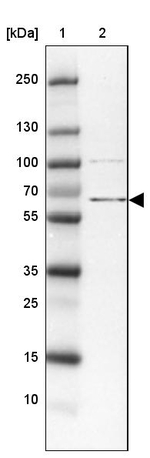 ZBED5 Antibody in Western Blot (WB)