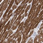 FAM47B Polyclonal Antibody