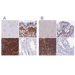 PPP1R18 Polyclonal Antibody