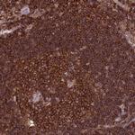 PPP1R18 Antibody in Immunohistochemistry (IHC)
