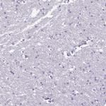 PPP1R18 Antibody in Immunohistochemistry (IHC)