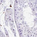 PPP1R18 Antibody in Immunohistochemistry (IHC)