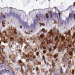 PPP1R18 Antibody in Immunohistochemistry (IHC)