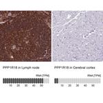 PPP1R18 Antibody