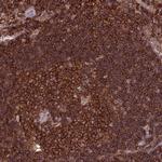 PPP1R18 Antibody in Immunohistochemistry (IHC)