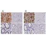 PNMT Polyclonal Antibody