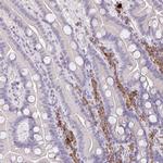 ZNF215 Polyclonal Antibody