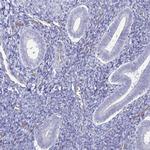 ACSBG2 Antibody in Immunohistochemistry (IHC)