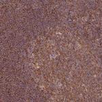 GGA1 Polyclonal Antibody