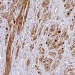 TARM1 Polyclonal Antibody