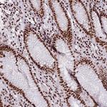 ZMYM6NB Antibody in Immunohistochemistry (Paraffin) (IHC (P))